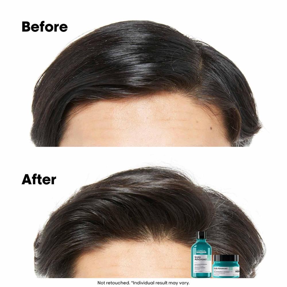 Scalp Advanced Anti-Oiliness_