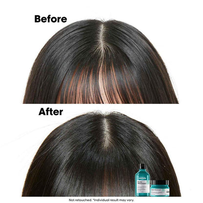 Scalp Advanced Anti-Oiliness_shampoo