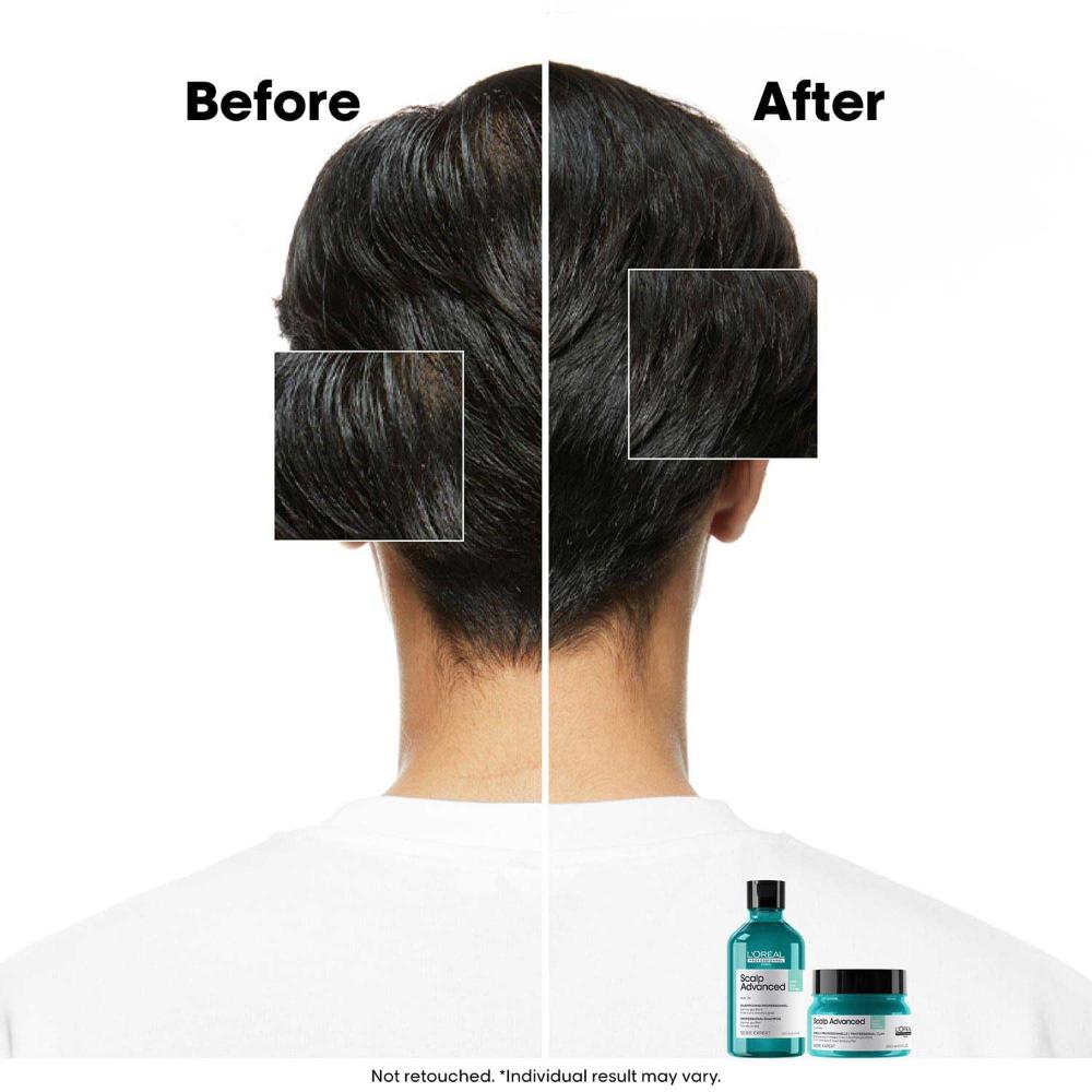 Scalp Advanced Anti-Oiliness_